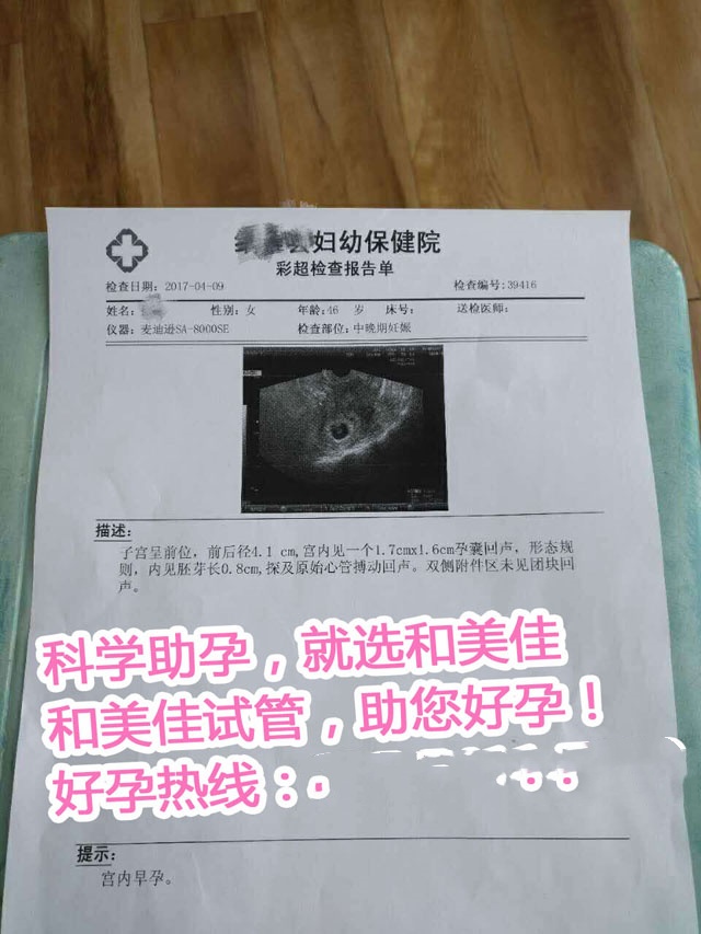广州代妈