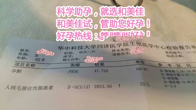 广州代妈